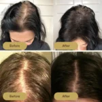 Houdini Vegan Hair Growth Oil - Image 4