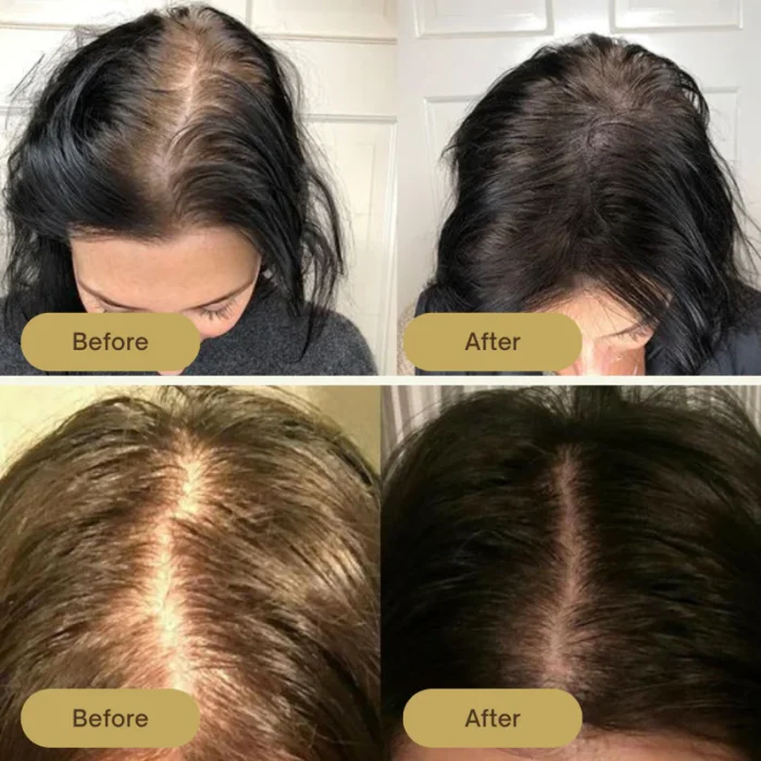 Houdini Vegan Hair Growth Oil - Image 4