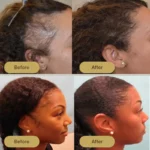 Houdini Vegan Hair Growth Oil - Image 3