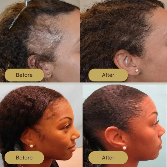 Houdini Vegan Hair Growth Oil - Image 3